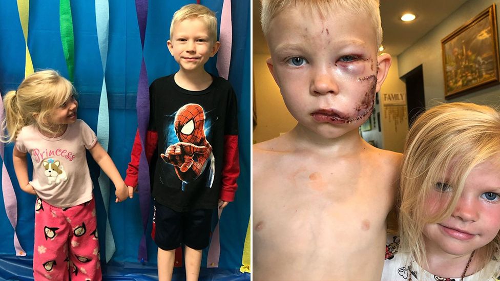 You're a hero': Chris Evans surprises six-year-old boy who saved his sister  from a dog attack | IMAGE.ie