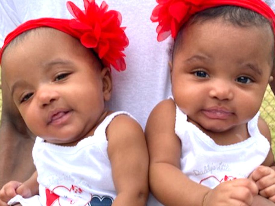 Michigan Dad Sustains Severe Burns Saving Twin Babies from Fire