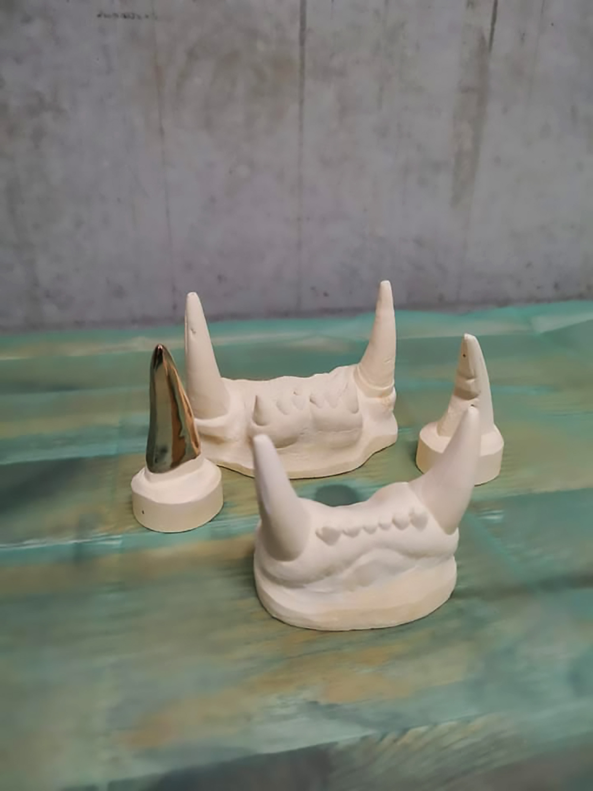  Casts were taken of Cara's front teeth to help create the gold implant