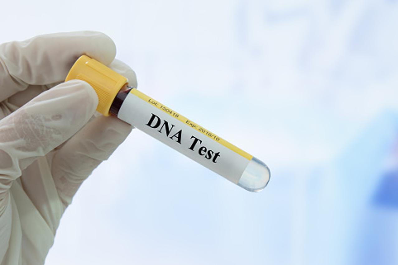 Par iz šale napravio DNK test pa doznao nešto što im je promijenilo živote - Večernji.hr