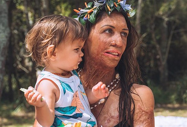 Turia Pitt celebrates her son Hakavai's first birthday with tropical-themed  party | Practical Parenting Australia