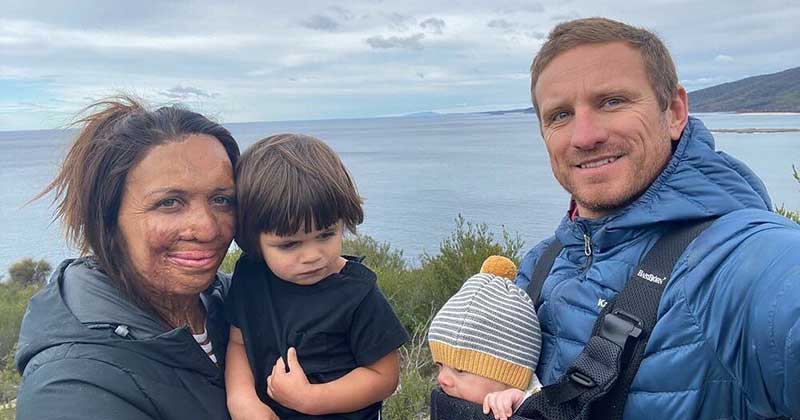 Everything you need to know about what happened to Turia Pitt - Tell Tale  Ladies