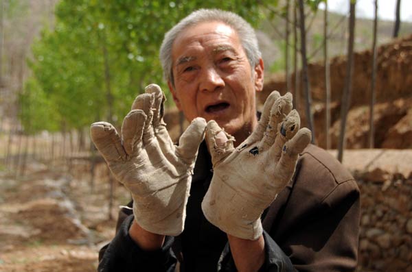 Legless veteran planted 3,000 trees in 10 years[2]- Chinadaily.com.cn